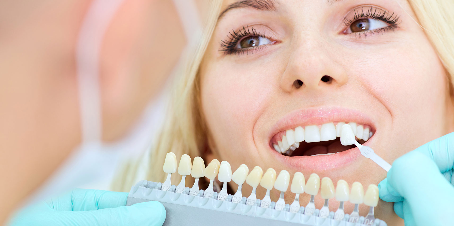 Dentist and patient checking dental veneers